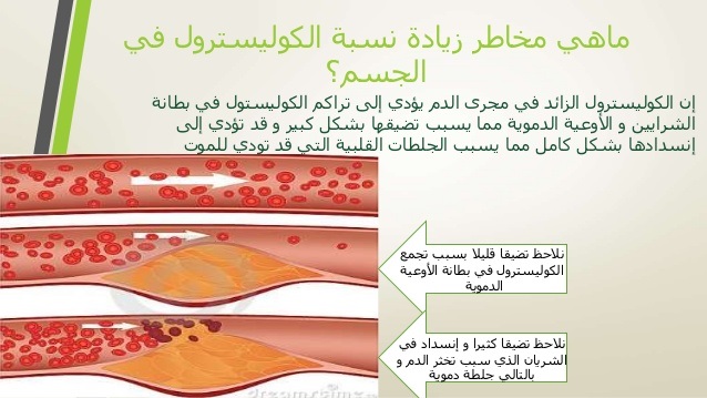 تعرف على أخطار ارتفاع نسبة الكوليسترول وطرق الوقاية