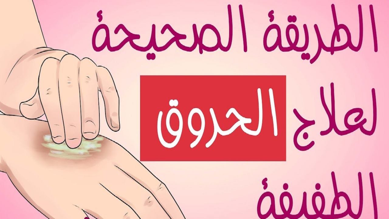 الناظر يُحذر الجميع من اتباع تلك العادات الخاطئة في التعامل مع الحروق والطرق الصحيحة